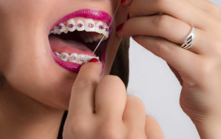 top 10 tips for cleaning braces