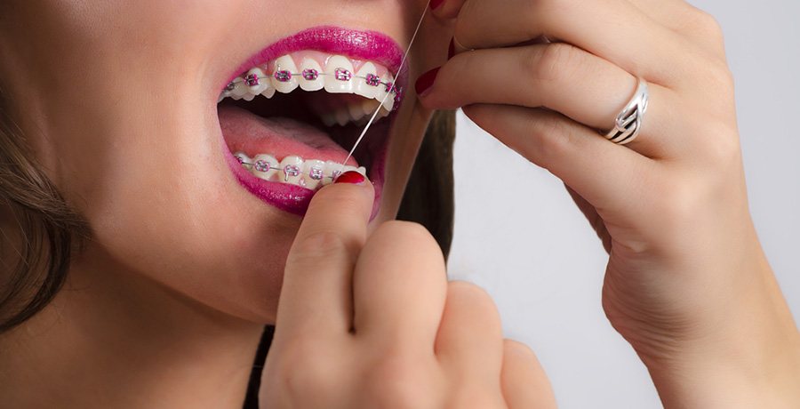 top 10 tips for cleaning braces