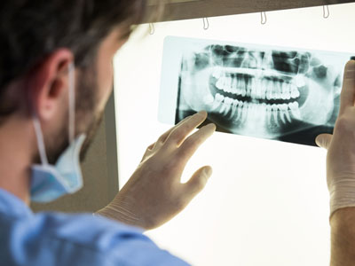 Doctor looking at xray of mouth