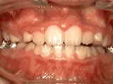 phase-1-after