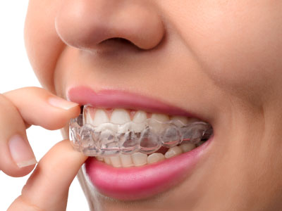 Woman putting on her Invisalign