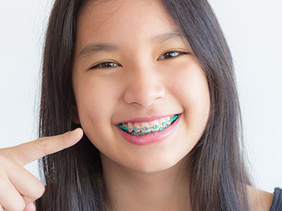 Five tips to prevent plaque! | Asian girl with braces smiling