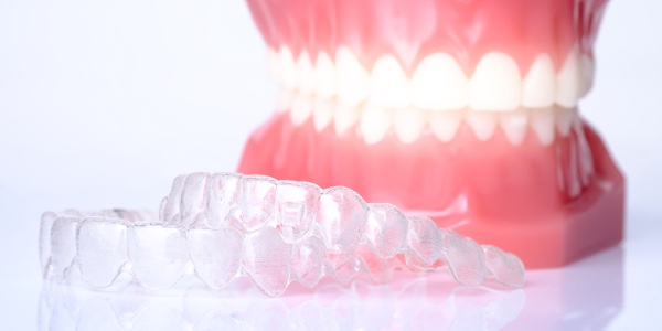 Clear Aligners