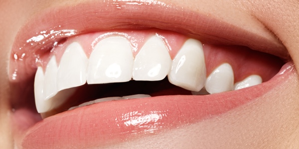 Whitening