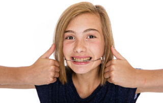 Headgear for dentofacial orthopedics