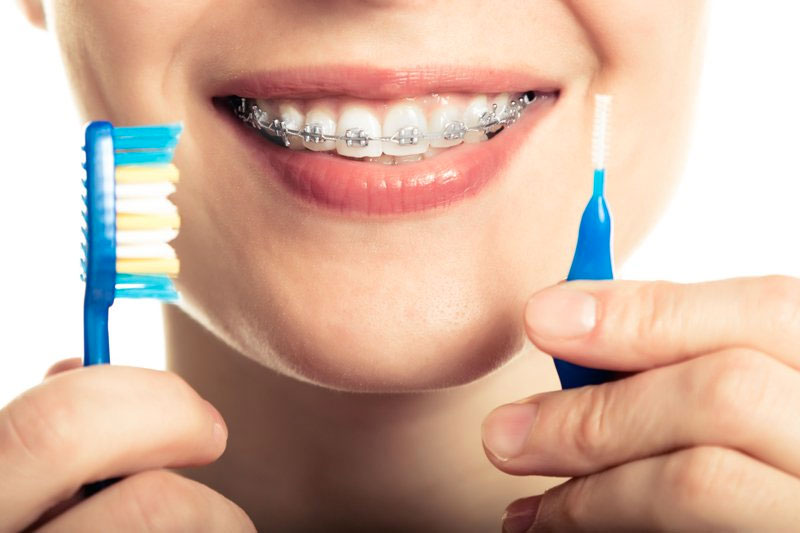 proxabrush for braces